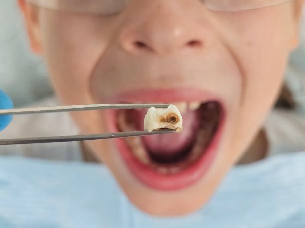 Best Emergency Dental Care for Trauma or Injury in Grosse Pointe Park, MI