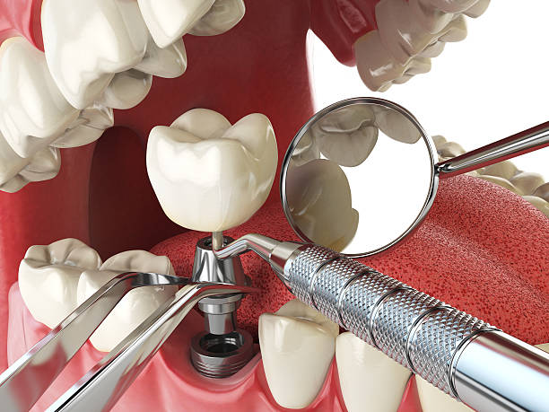 Best Emergency Broken Tooth Repair in Grosse Pointe Park, MI