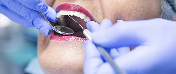 Best Emergency Treatment for Toothache in Grosse Pointe Park, MI