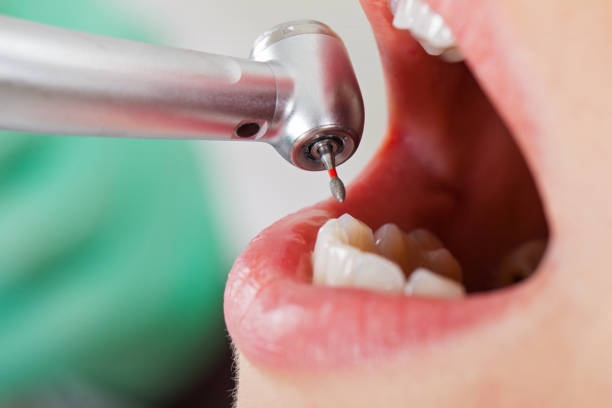 Best Emergency Dental Care for Trauma or Injury in Grosse Pointe Park, MI